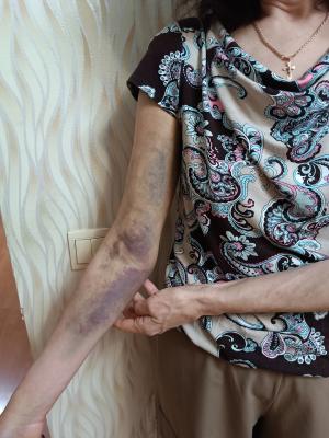 В Рязани школьную учительницу избили, приняв её за закладчицу