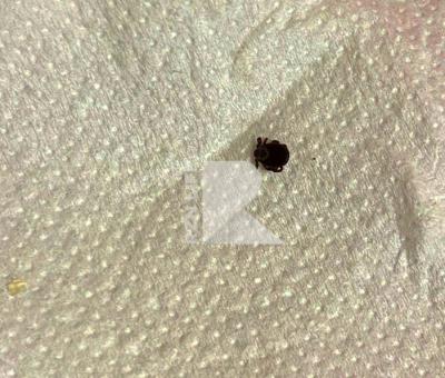 В Ермишинском районе Рязанской столкнулись с первым клещом