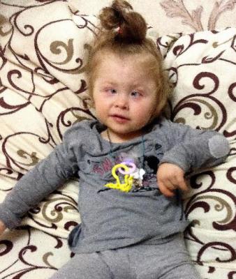 Маленькой рязанке нужна помощь