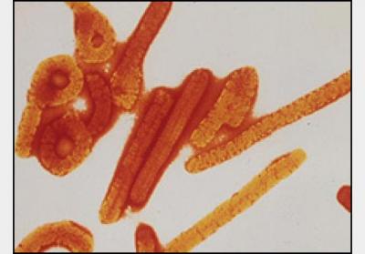 Студентов РязГМУ проверят на лихорадку Эбола