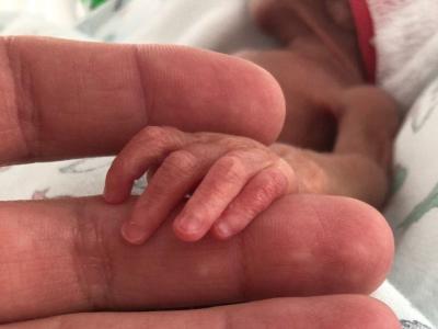 В Рязанском перинатальном центре выходили девочку весом 450 граммов
